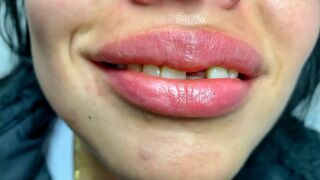 DENTAL PROSTHESIS FLEXIBLE ????