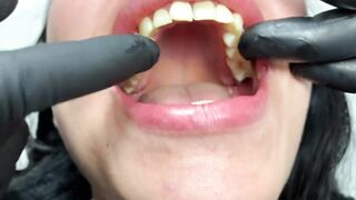DENTAL PROSTHESIS FLEXIBLE ????