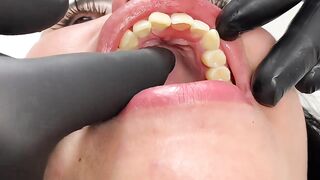 DENTAL PROSTHESIS FLEXIBLE ????