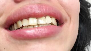 DENTAL PROSTHESIS FLEXIBLE ????