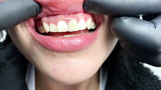 DENTAL PROSTHESIS FLEXIBLE ????