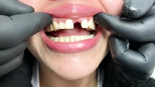 DENTAL PROSTHESIS FLEXIBLE ????