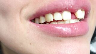 DENTAL PROSTHESIS FLEXIBLE ????