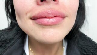 DENTAL PROSTHESIS FLEXIBLE ????