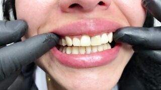 DENTAL PROSTHESIS FLEXIBLE ????