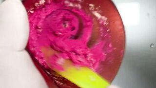 DENTAL PROSTHESIS FLEXIBLE ????