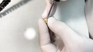 DENTAL PROSTHESIS FLEXIBLE ????