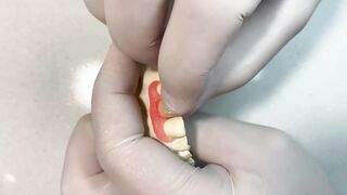 DENTAL PROSTHESIS FLEXIBLE ????