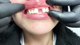 DENTAL PROSTHESIS FLEXIBLE ????